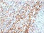 Fibronectin Antibody in Immunohistochemistry (Paraffin) (IHC (P))