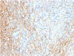 Fibronectin Antibody in Immunohistochemistry (Paraffin) (IHC (P))