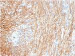 Fibronectin Antibody in Immunohistochemistry (Paraffin) (IHC (P))