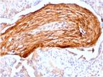 Fibronectin Antibody in Immunohistochemistry (Paraffin) (IHC (P))