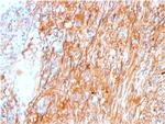 Fibronectin Antibody in Immunohistochemistry (Paraffin) (IHC (P))