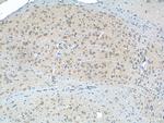 GRIA4 Antibody in Immunohistochemistry (Paraffin) (IHC (P))