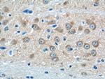 GRIA4 Antibody in Immunohistochemistry (Paraffin) (IHC (P))