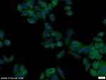 FOLR1 Antibody in Immunocytochemistry (ICC/IF)