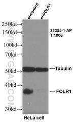 FOLR1 Antibody in Western Blot (WB)