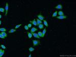 FKBPL Antibody in Immunocytochemistry (ICC/IF)