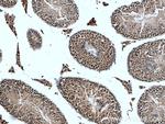 PIAS1 Antibody in Immunohistochemistry (Paraffin) (IHC (P))