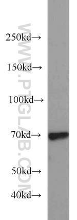 PIAS1 Antibody in Western Blot (WB)