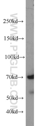 PIAS1 Antibody in Western Blot (WB)