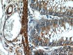 RANKL Antibody in Immunohistochemistry (Paraffin) (IHC (P))