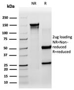 Sirtuin 3 (SIRT3) Antibody in SDS-PAGE (SDS-PAGE)