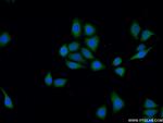 DOCK180 Antibody in Immunocytochemistry (ICC/IF)