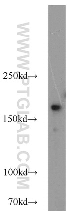 DOCK180 Antibody in Western Blot (WB)