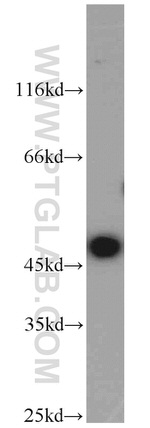 ADH7 Antibody in Western Blot (WB)