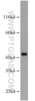 ADH7 Antibody in Western Blot (WB)