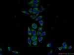 KHDC1 Antibody in Immunocytochemistry (ICC/IF)