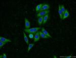 UBQLN2 Antibody in Immunocytochemistry (ICC/IF)