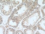 UBQLN2 Antibody in Immunohistochemistry (Paraffin) (IHC (P))