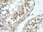 UBQLN2 Antibody in Immunohistochemistry (Paraffin) (IHC (P))