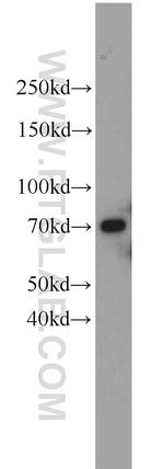 UBQLN2 Antibody in Western Blot (WB)