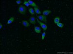 UBQLN2 Antibody in Immunocytochemistry (ICC/IF)