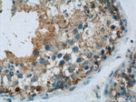 UBQLN2 Antibody in Immunohistochemistry (Paraffin) (IHC (P))