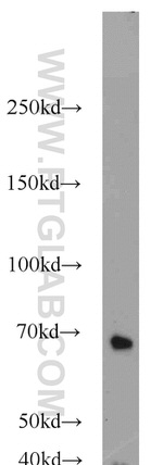 UBQLN2 Antibody in Western Blot (WB)