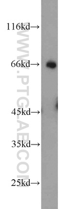 UBQLN2 Antibody in Western Blot (WB)