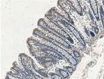 XIAP Antibody in Immunohistochemistry (Paraffin) (IHC (P))