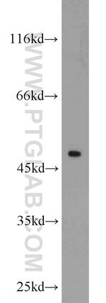 XIAP Antibody in Western Blot (WB)