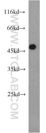 XIAP Antibody in Western Blot (WB)