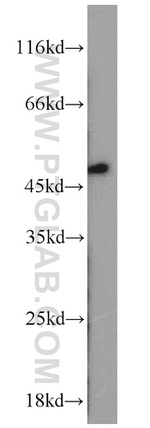 XIAP Antibody in Western Blot (WB)