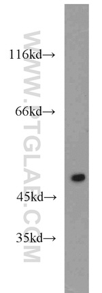 XIAP Antibody in Western Blot (WB)