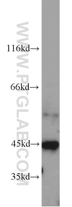 TNFAIP3 Antibody in Western Blot (WB)