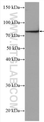 IL-6R Antibody in Western Blot (WB)