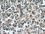 IL-6R Antibody in Immunohistochemistry (Paraffin) (IHC (P))