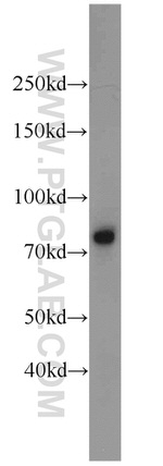 IL-6R Antibody in Western Blot (WB)