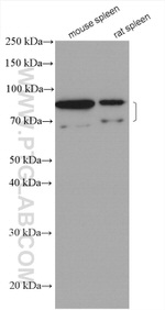 IL-6R Antibody in Western Blot (WB)