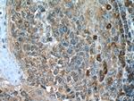 IL-6R Antibody in Immunohistochemistry (Paraffin) (IHC (P))