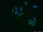 AMH Antibody in Immunocytochemistry (ICC/IF)