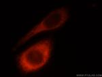 LAMB1 Antibody in Immunocytochemistry (ICC/IF)