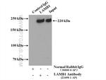 LAMB1 Antibody in Immunoprecipitation (IP)