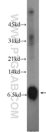 Mammaglobin A Antibody in Western Blot (WB)