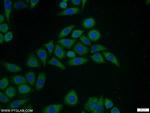 Ubiquilin 1 Antibody in Immunocytochemistry (ICC/IF)