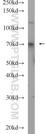 Ubiquilin 1 Antibody in Western Blot (WB)