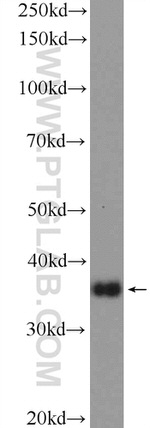 HOXD13 Antibody in Western Blot (WB)