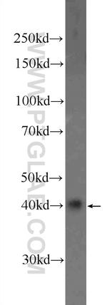 HOXD13 Antibody in Western Blot (WB)