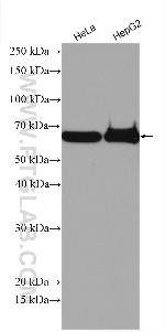 ESCO2 Antibody in Western Blot (WB)