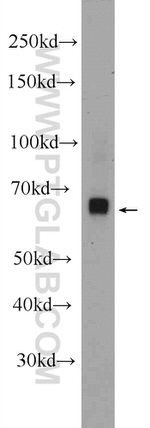 ESCO2 Antibody in Western Blot (WB)