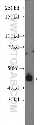 Retinal S antigen Antibody in Western Blot (WB)